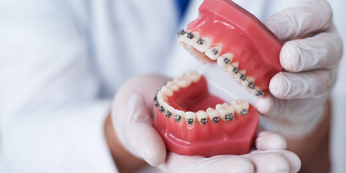 Why orthodontics decorative image